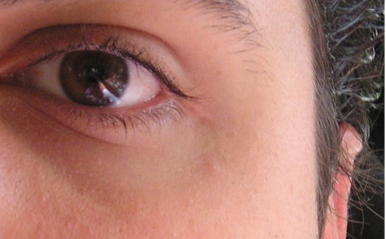 Investigadores de la UA desarrollan un software de alta precisión para diagnóstico de la sensibilidad ocular