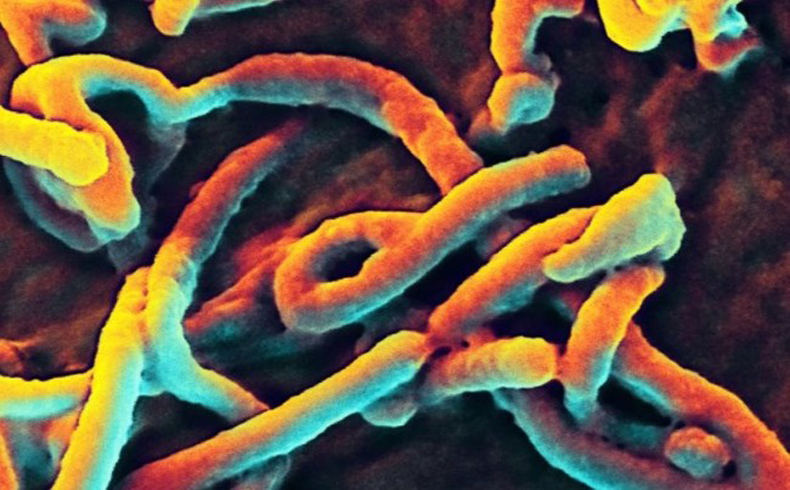 Científicos del Ejército se esfuerzan por desarrollar una vacuna contra el ébola