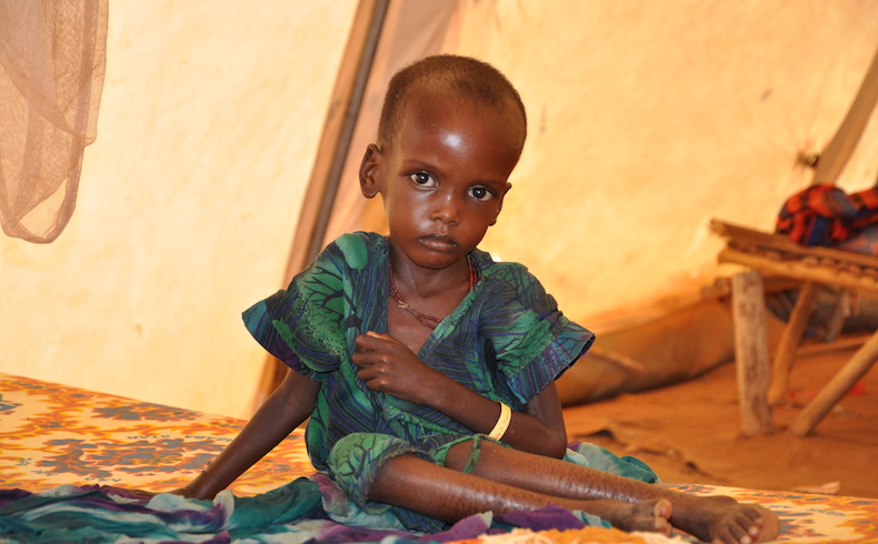 3,1 millones de niños menores de cinco años mueren cada año en África por desnutrición